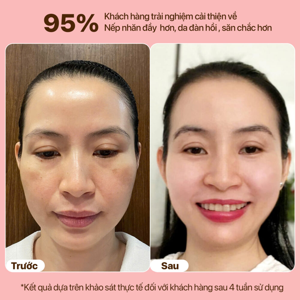 LUMIAURA NIACINAMIDE ALPHA BRIGHTENING CREAM